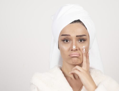 Peeling chimic vs microneedling – Ce tratament facial funcționează mai bine?